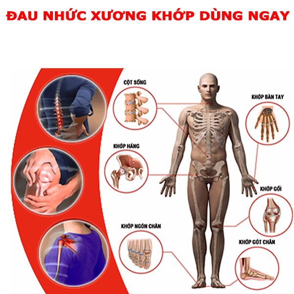  hỗ trợ điều trị xương khớp