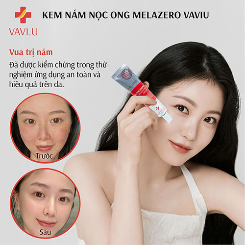 Kem trị nám