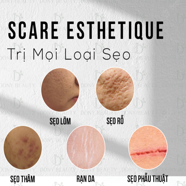 kem tri seo mụn 